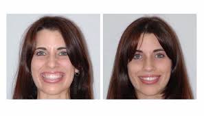 Botox and Dermal Filler Certified